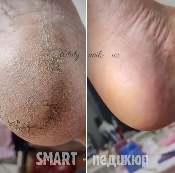 Маникюр, Педикюр, Наращивание ногтей, Мужской Маникюр и педикюр