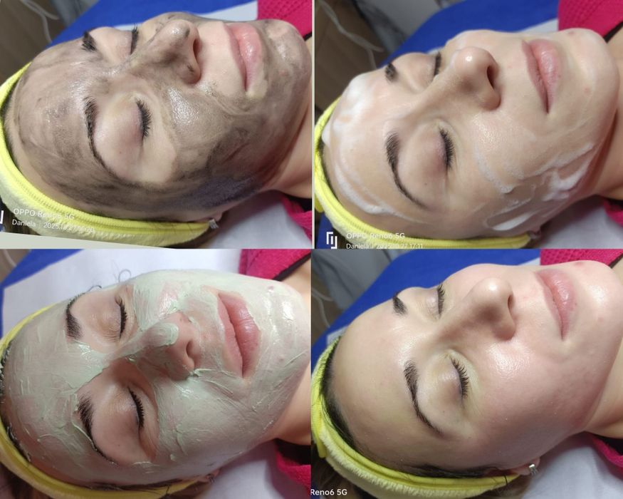 Tratamente faciale ,pensat și epilat cu ceara!