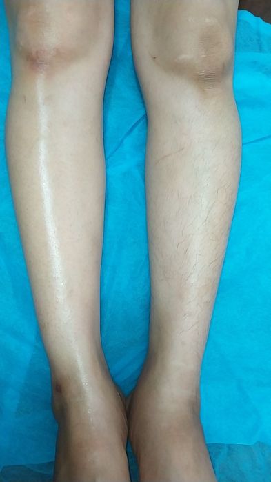 Женская депиляция  Аёллар учун депил-я Сергели7  напротив Халкаро макт