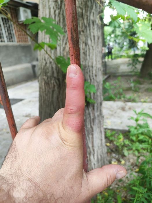Срочно продаются решетки забор