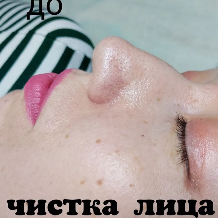 Услуги косметолога