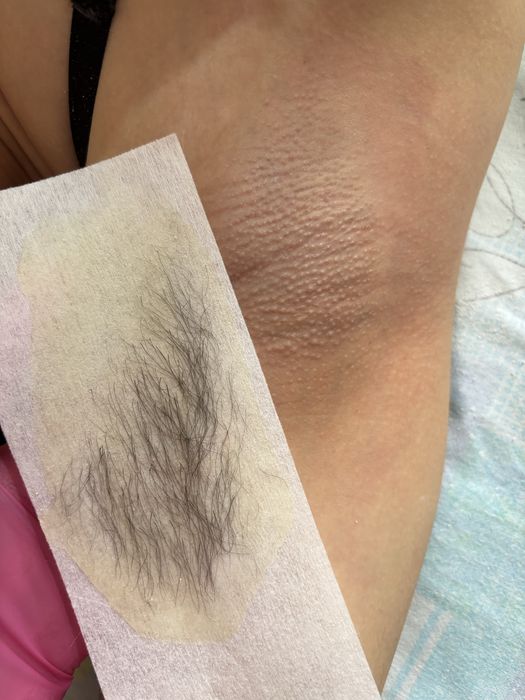 Шугаринг с выездом