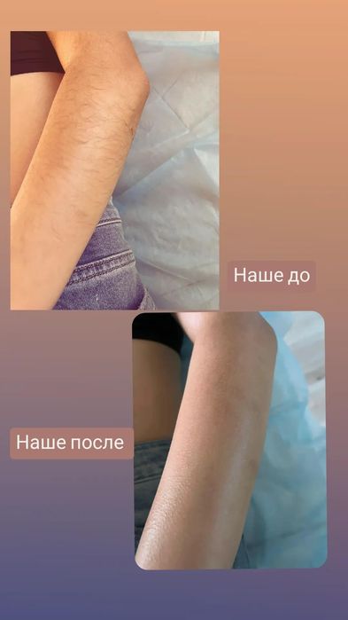 Шугаринг женский воском