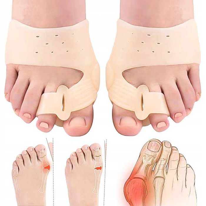 Разделители шини за коригиране на пръсти на краката, Ортеза коректор