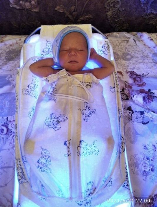 Фотолампа от желтушки, фототерапия, аренда фотолампы