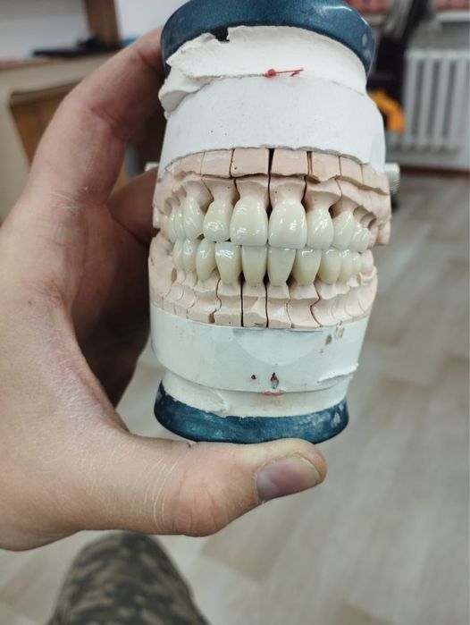 Изготовление протезов в Астане