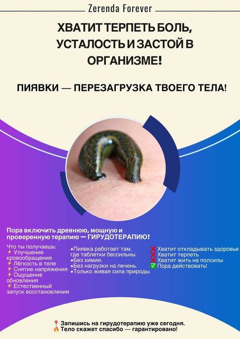 продам пиявки свежие