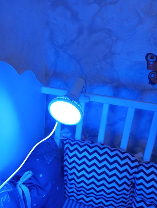 Лампа от желтушки