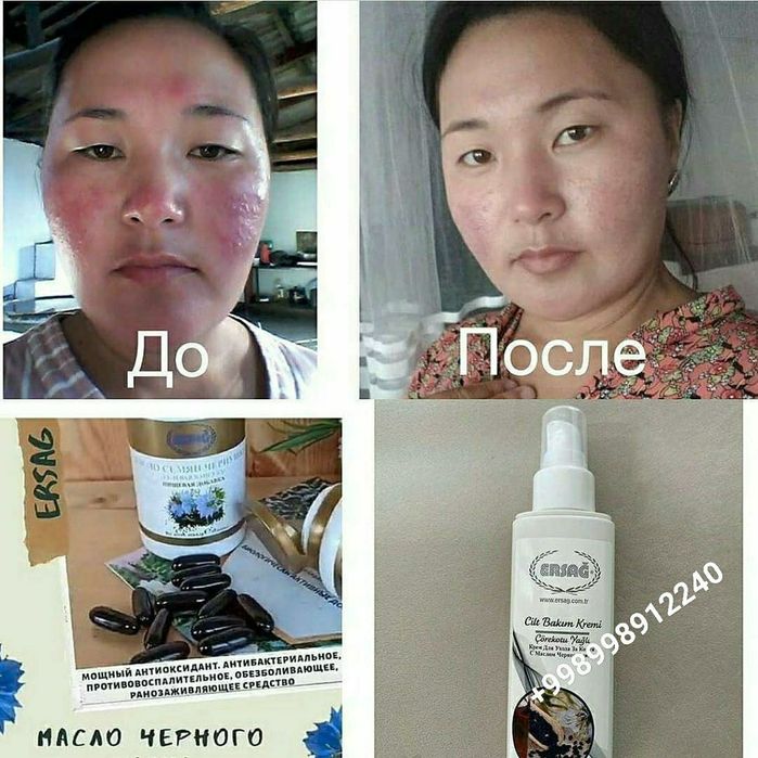 Масло черного тмина от Эрсаг