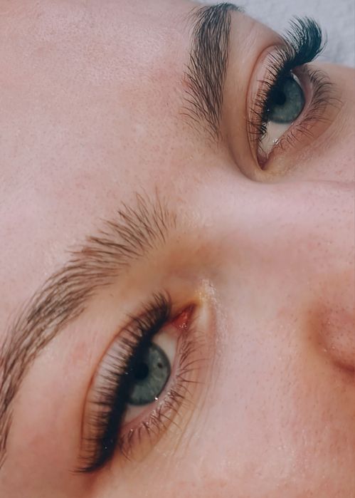 Extensii gene Galati