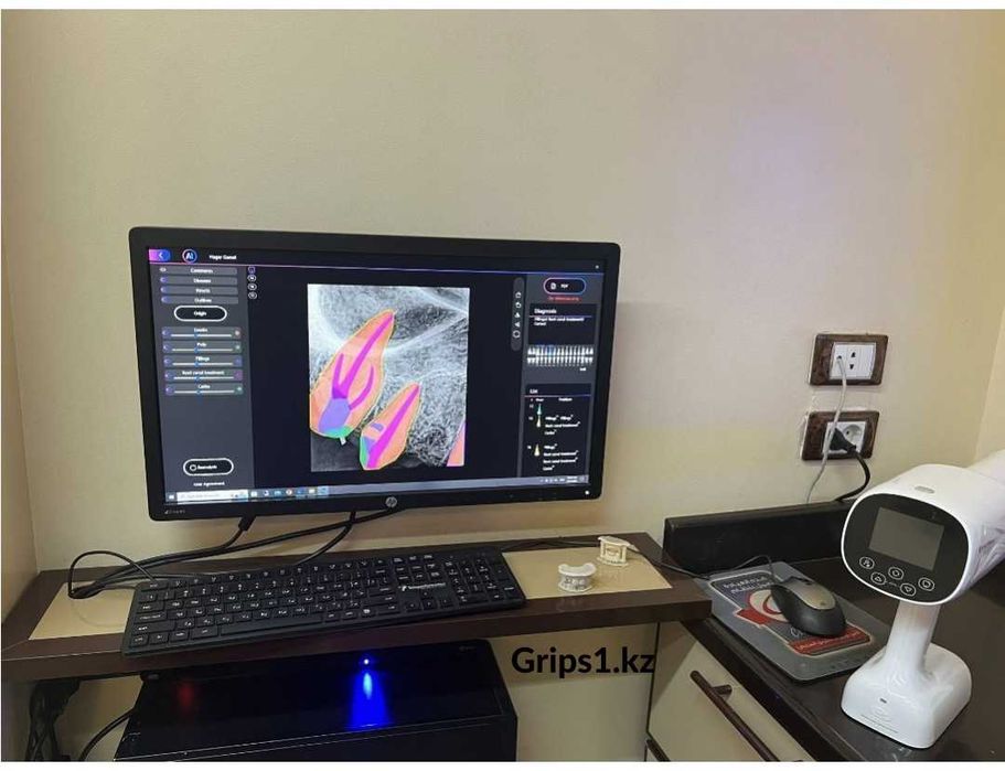 Визиограф PhoCo Mini - сенсор с AI модулем. Радиовизиограф