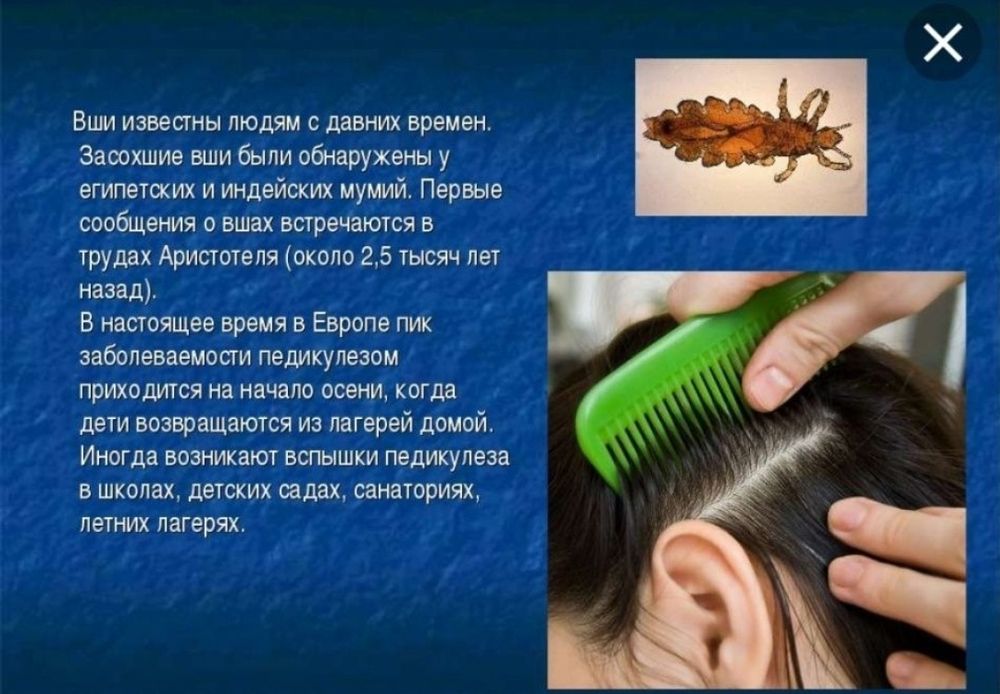 Vaacum eliminant аппарати bit sirka tozalidigan