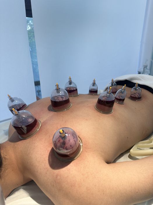 ХИДЖАМА | Астана