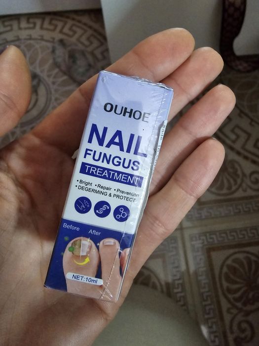 Препарат за гъбички по ноктите