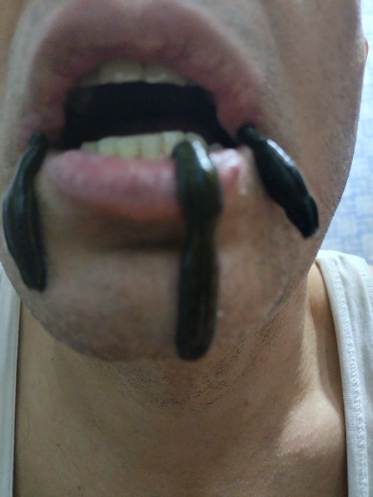 тиббий зулуклар медицинский пиявки