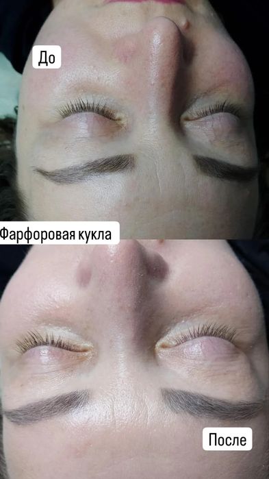 Услуги косметолога