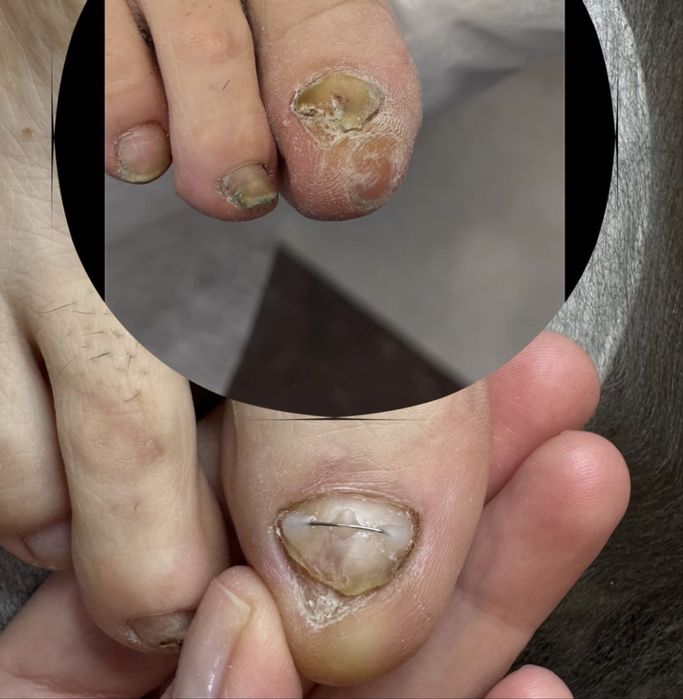 Мужской педикюр от А до Я