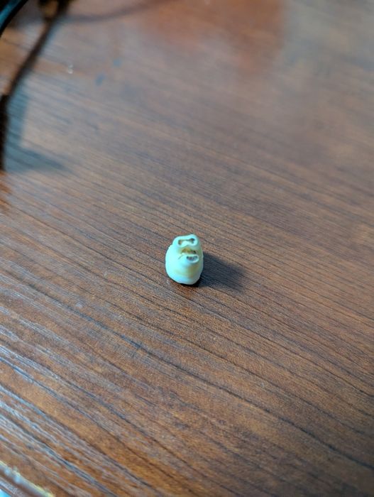 Зуб мудрости в отличном состоянии