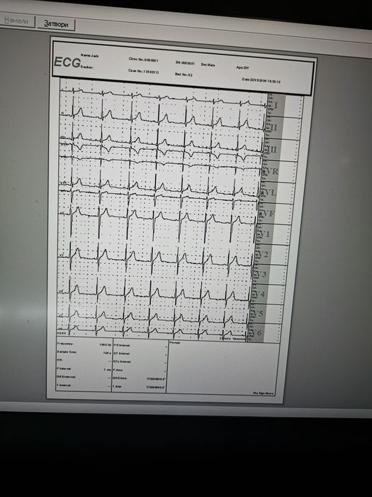 ЕКГ Апарат 12 канала Contec E90A с софтуер за компютър