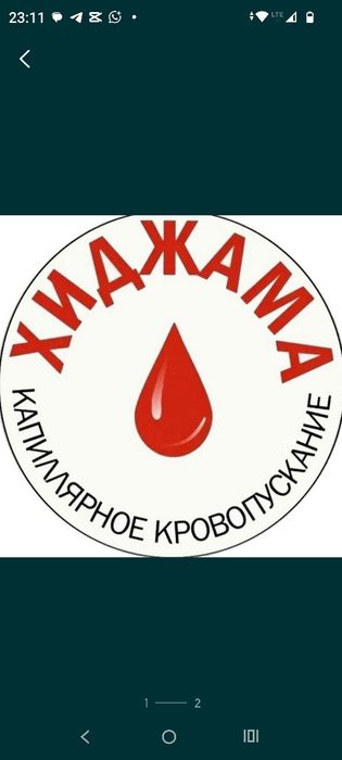 Хиджама профессиональный