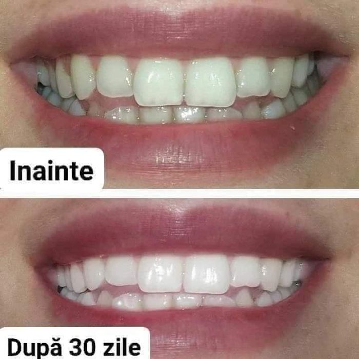 Pasta de dinti albire Ap24 set 3 buc Nuskin