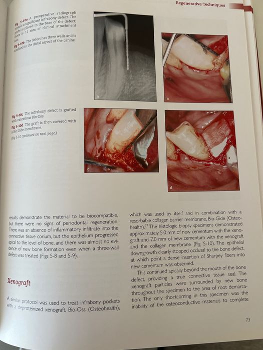Tissue Engineering