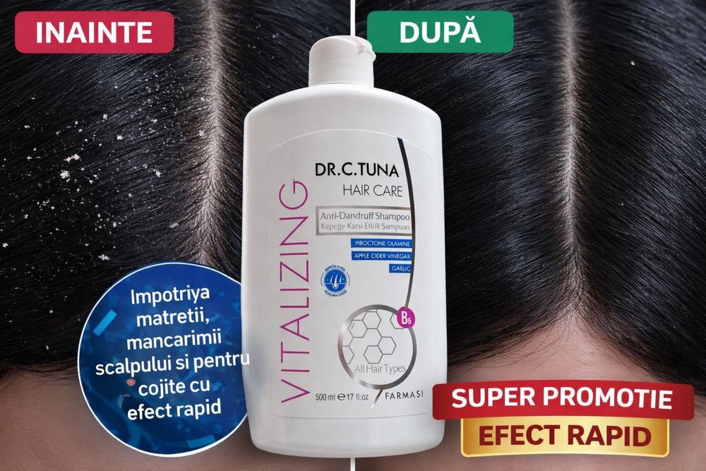 Sampon cu otet de mere antimatreata