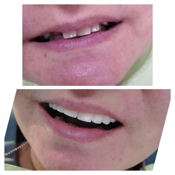 Услуги стоматолога