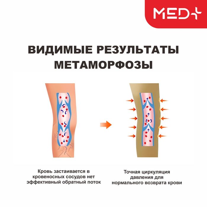 Лимфопресс для ног