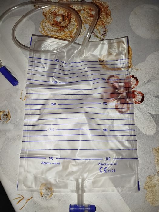 Yangi siydik qopchalari - urine bag 2000 ml