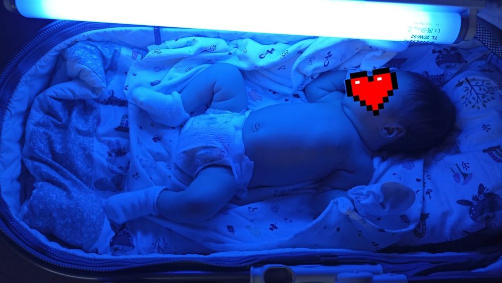 ФОТОЛампА. ЖелтушкА.