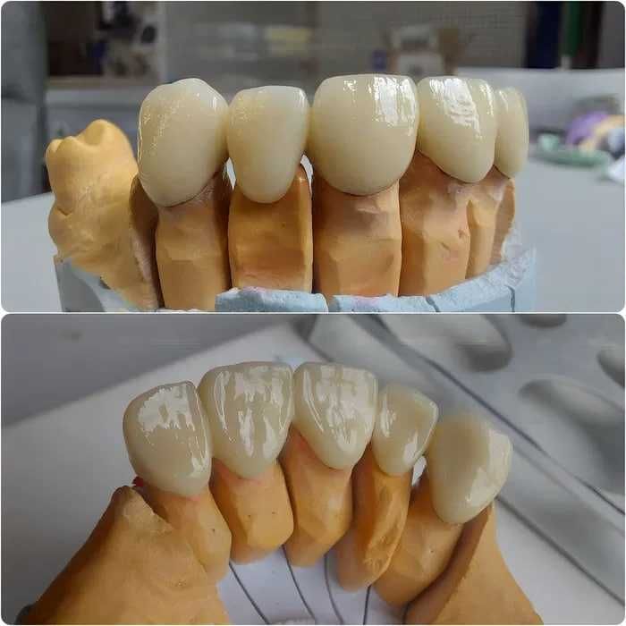 CAD/CAM – Цифровая зуботехническая стоматология