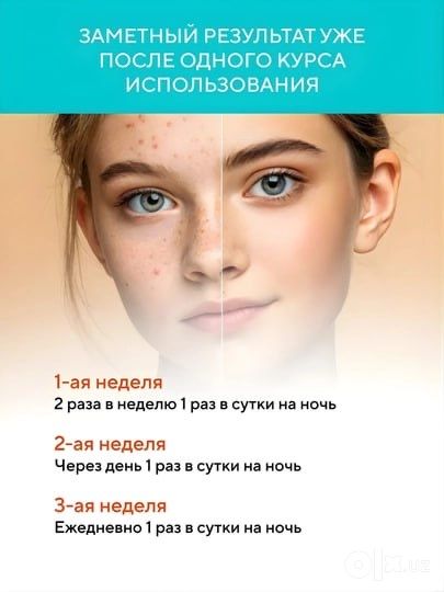 Tretinoin 0.025 % Menarini