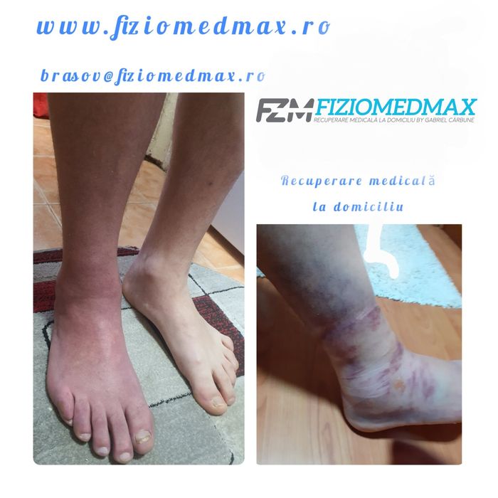 Kinetoterapie/Fizioterapie/Recuperare medicala si masaj la domiciliu