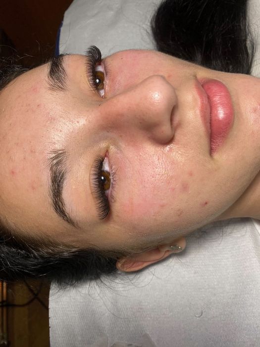 Aplic extensii de gene