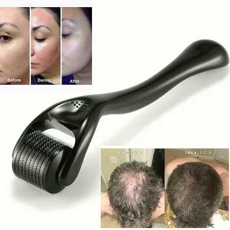 Дерма ролер 540 титаниеви игли, Срещу оплешивяване, Подмладява кожата