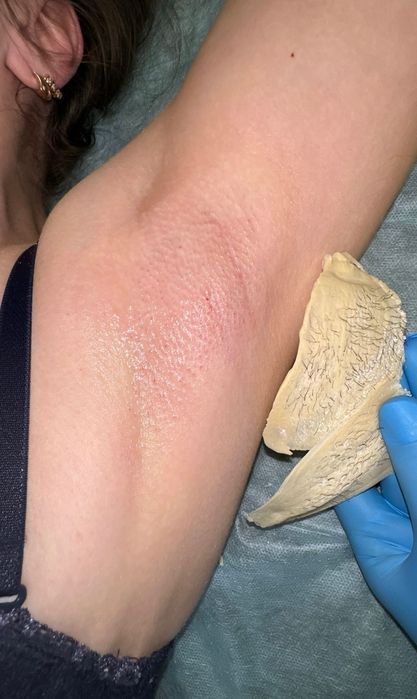 Шугаринг полимер воск