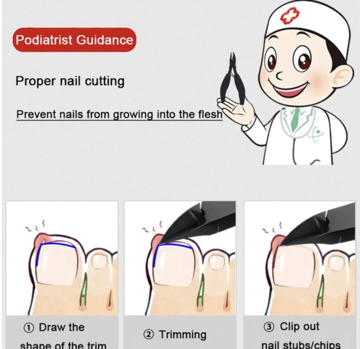 Клещи/Резачки за нокти и врастнали нокти