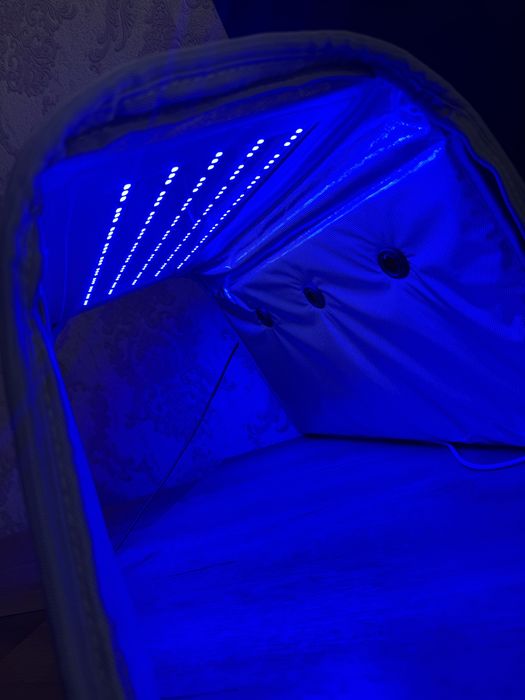 Фотолампа от желтушки