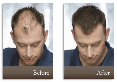 Кератинови фибри за коса Топик 27.5гр.