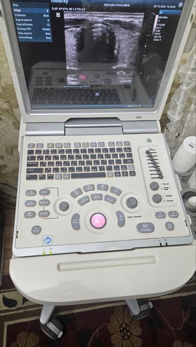 УЗИ аппарат сотилади