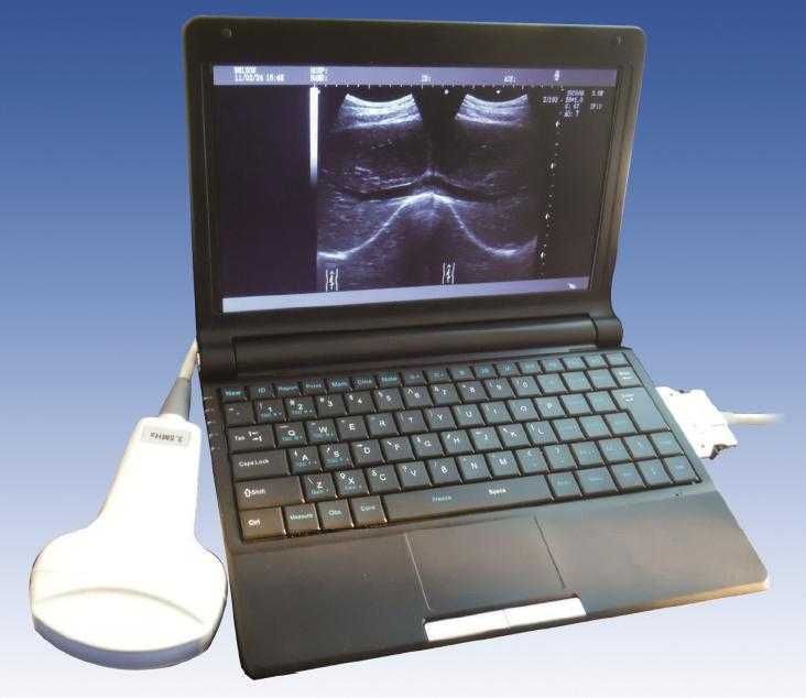 ecograf portabil laptop, cu sonda convexa si liniara, baterie 4h