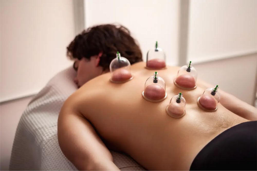 Kinetoterapie, reflexoterapie, masaj si ventuze (cupping therapy)