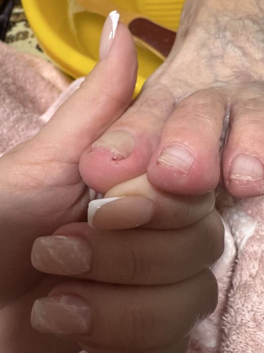 Педикюр на выезд