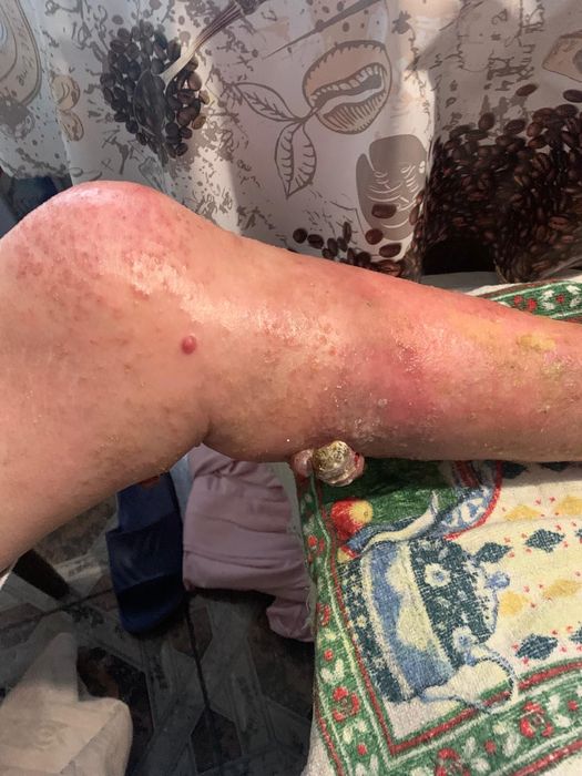 Хладилен Транспорт -20 /+20 Двутемперетурен/ Фактура