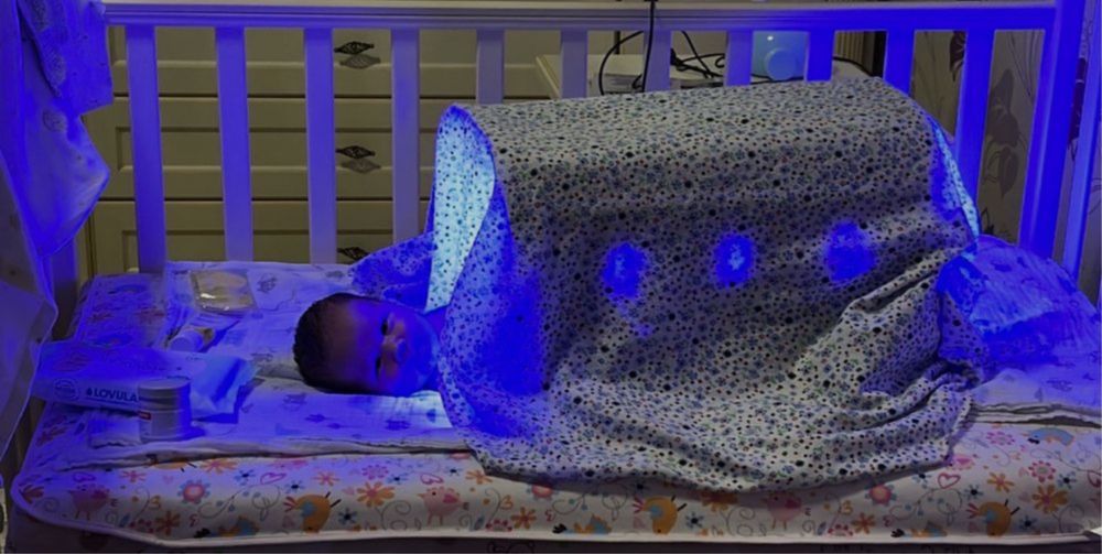 Фотолампа от желтухи