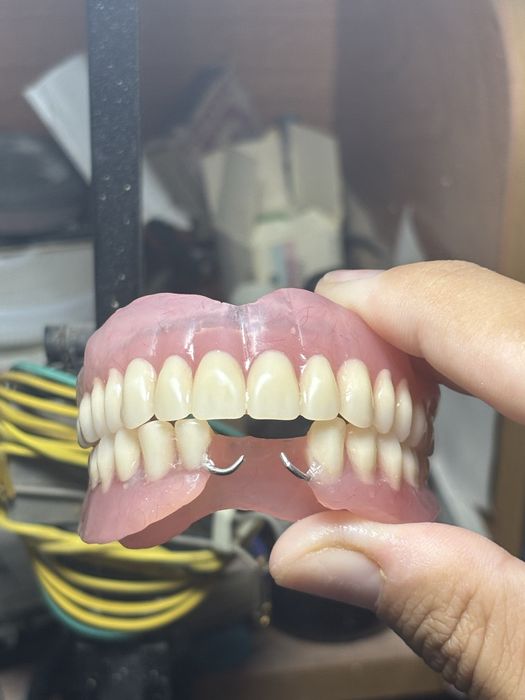 Изготовление сьемных протезов