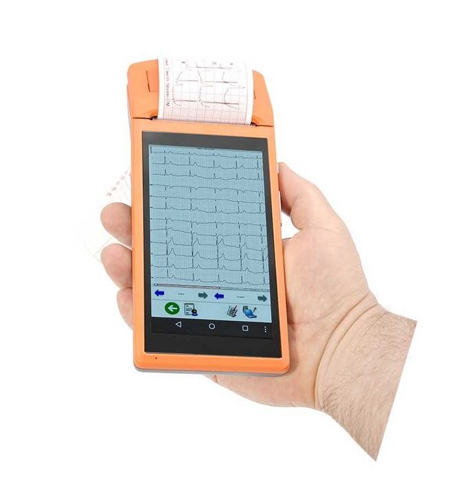 Мобильный беспроводной электрокардиограф “Кардиан-ПМ”