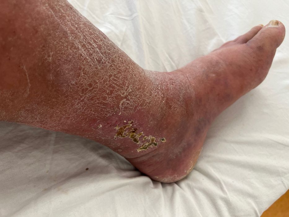 Voi vinde o brichetă de benzină Zippo cu o copertă.