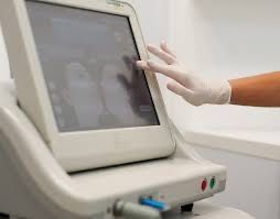 СМАС Лифтинг Ulthera аппарат для Альтера терапии